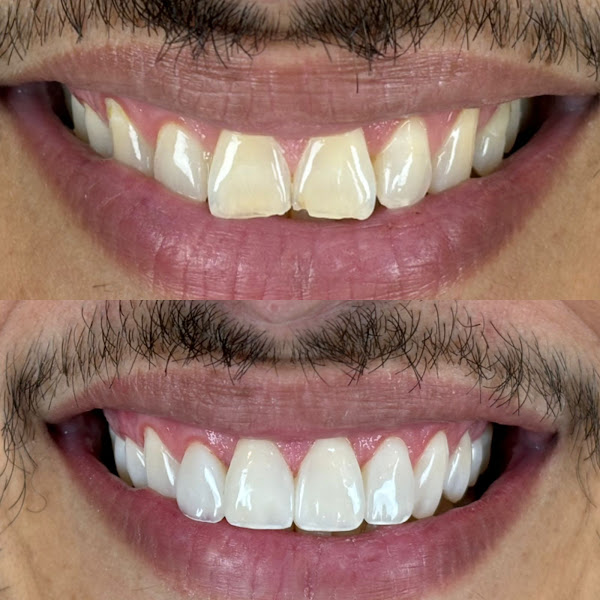 Foto 3 de Larissa Ferreira Dentista