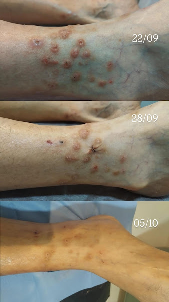 Foto 3 de Laserterapia - Especialista no Cuidado com a Família