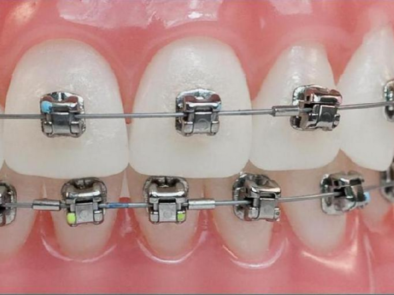 Foto 2 de Laura Dorneles - Consultório Odontológico