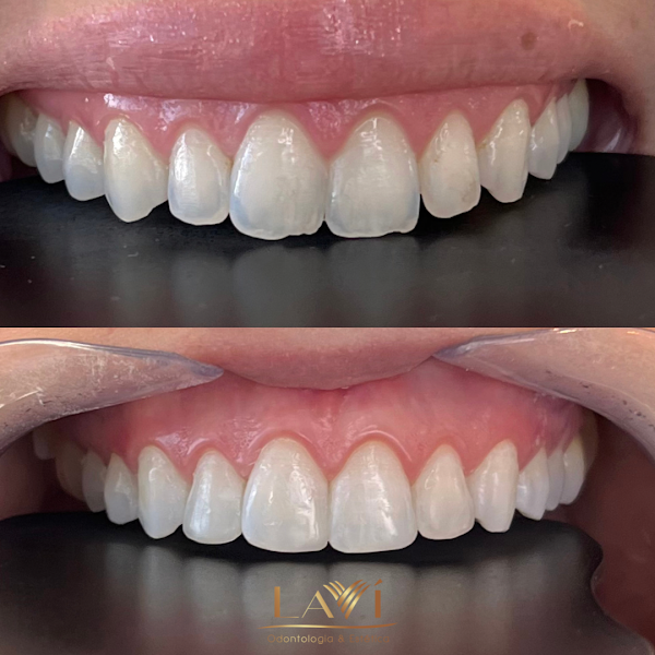 Foto 2 de Lavi Odontologia e Estética
