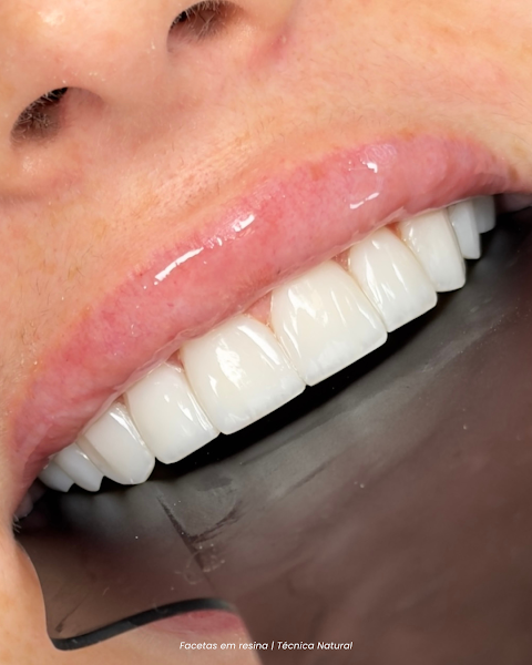 Foto 2 de LB Odontologia Estética