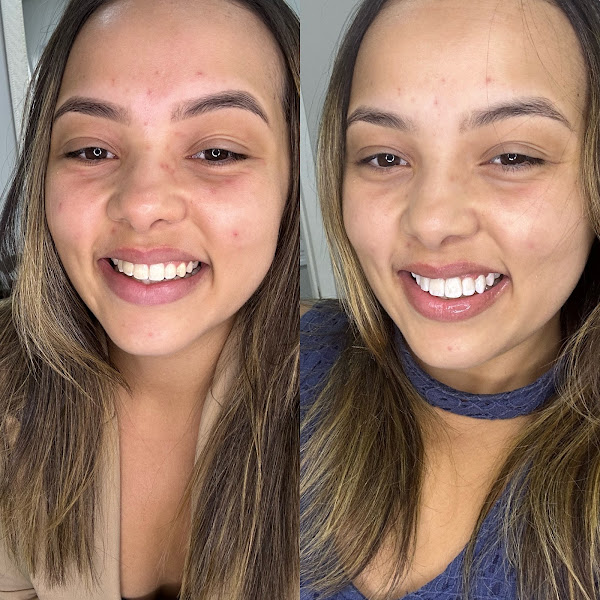 Foto 3 de LB Odontologia Integrada - Dra. Leticia Brito