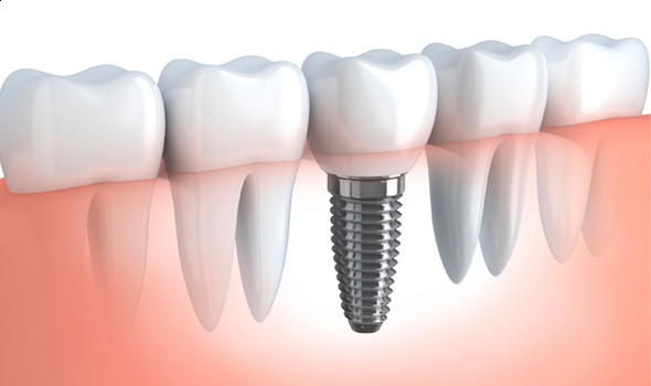Foto 2 de LDF Odontologia