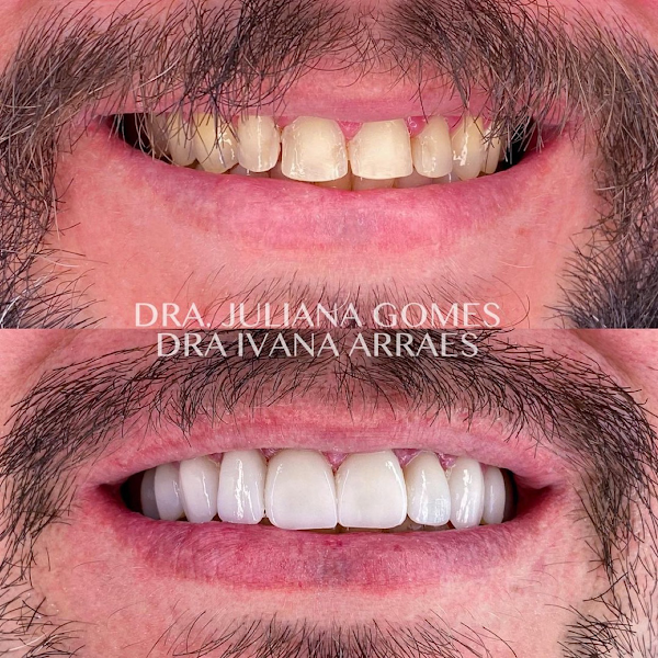 Foto 2 de Le Blanc Odonto (Consultório Odontológico)