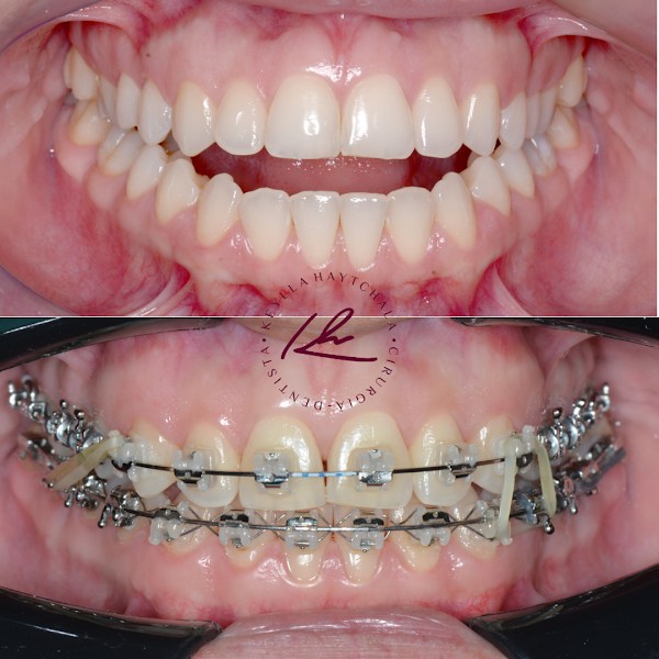 Foto 2 de Le Blanc Odontologia+