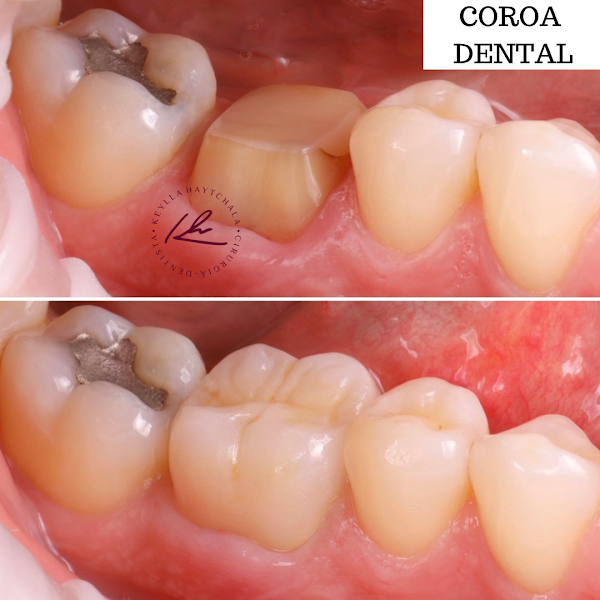 Foto 3 de Le Blanc Odontologia+