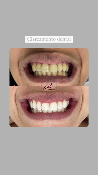 Foto 4 de Le Blanc Odontologia+