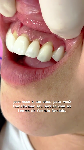 Foto 4 de Le Blue Odontologia - Dentista Passo Fundo