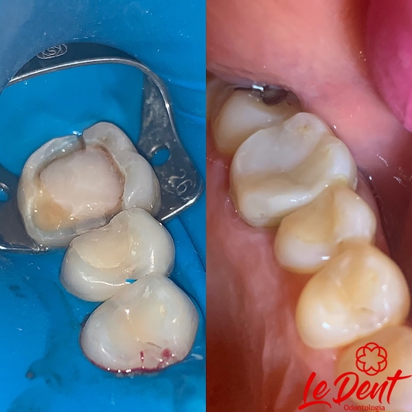 Foto 2 de Le Dent Odontologia & Bem Estar