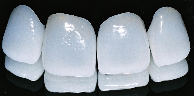 Foto 3 de Le Michelin Odontologia Estética