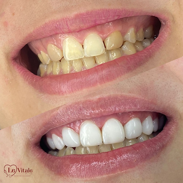 Foto 3 de Le Vitale Odonto