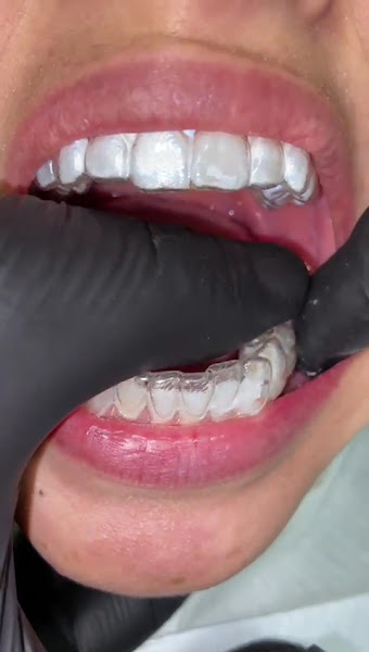 Foto 4 de Leal Clínic Brooklin Paulista - Dentista Brooklin Paulista - Implante Dentário Brooklin Paulista