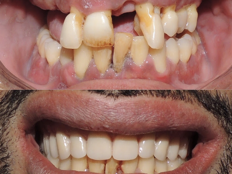 Foto 3 de Leandro Modesto / Odontomodesto