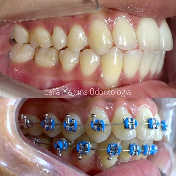 Foto 2 de Leila Martins Odontologia