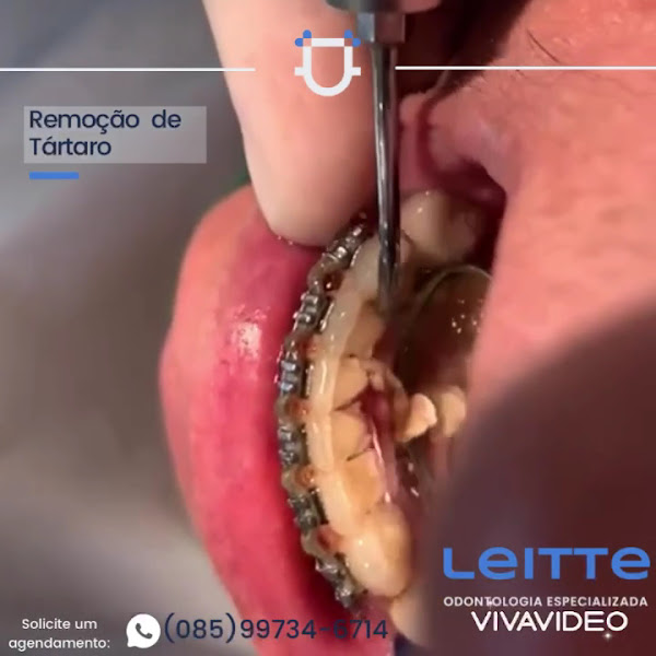 Foto 3 de Leitte Odontologia Especializada