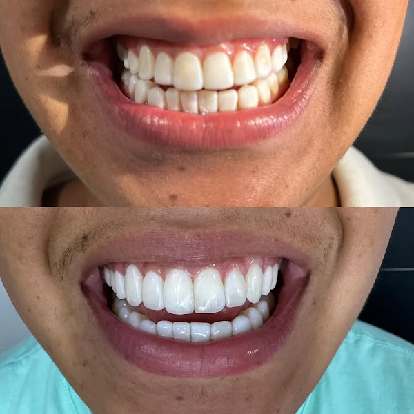 Foto 3 de Lelis Odontologia - Unidade I