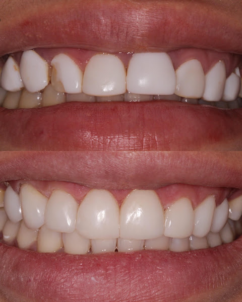 Foto 3 de Leme Odontologia