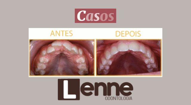 Foto 3 de LENNE ODONTOLOGIA