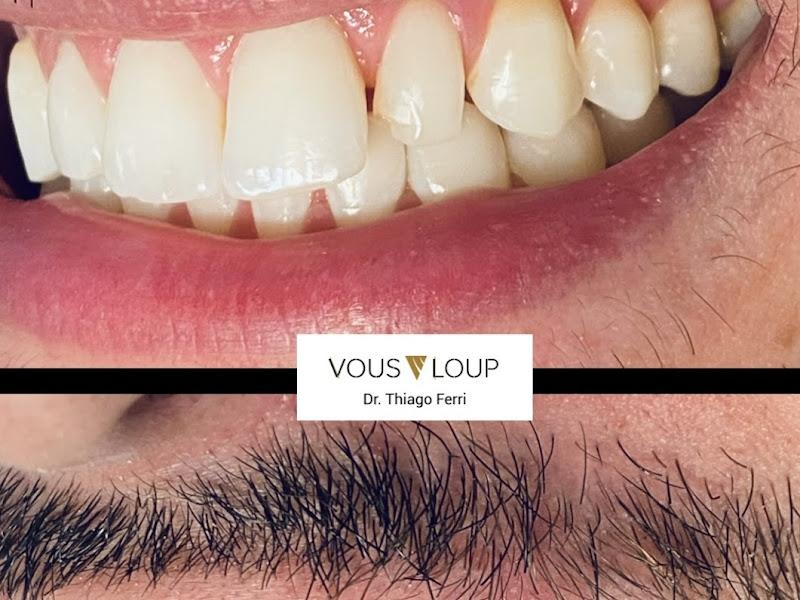 Foto 10 de Lente by Brum Odontologia