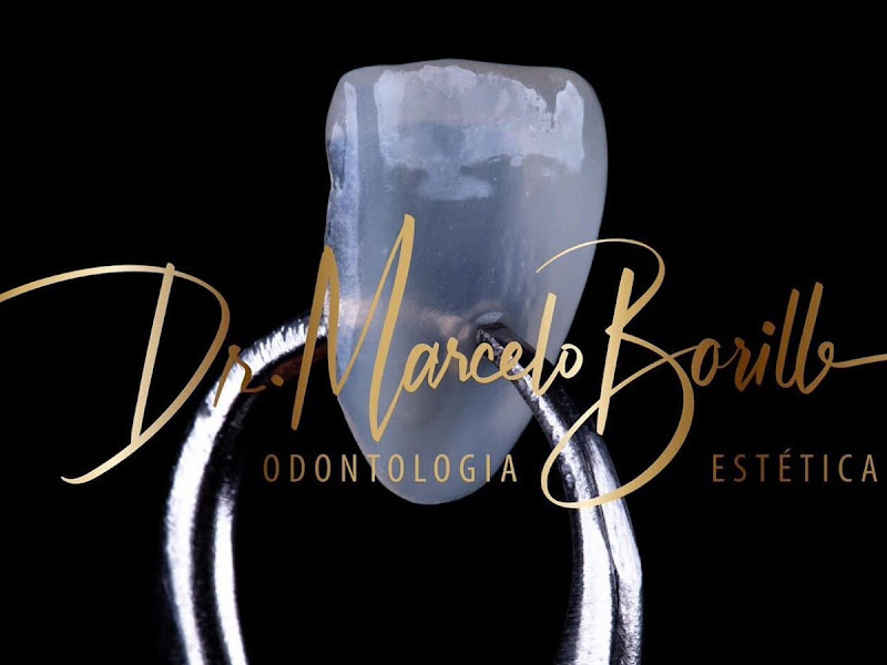 Foto 2 de Lente de contato dental