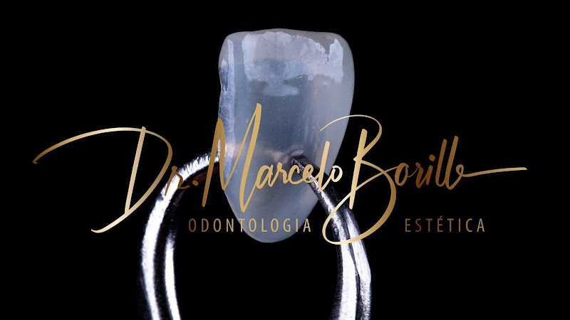 Foto 2 de Lente de Contato Dental, Dr. Marcelo Borille