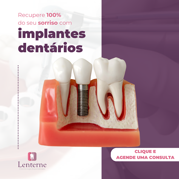 Foto 3 de LENTERNE ODONTOLOGIA