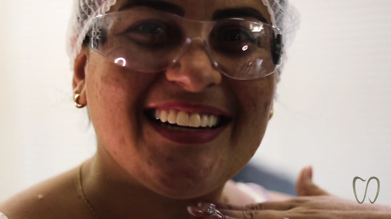 Foto 3 de Lentes de Contato Dentais | Dra. Nildenise Albuquerque