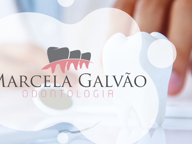 Foto 7 de Lentes de Contato Dental São Luís MA - T&L Odontologia