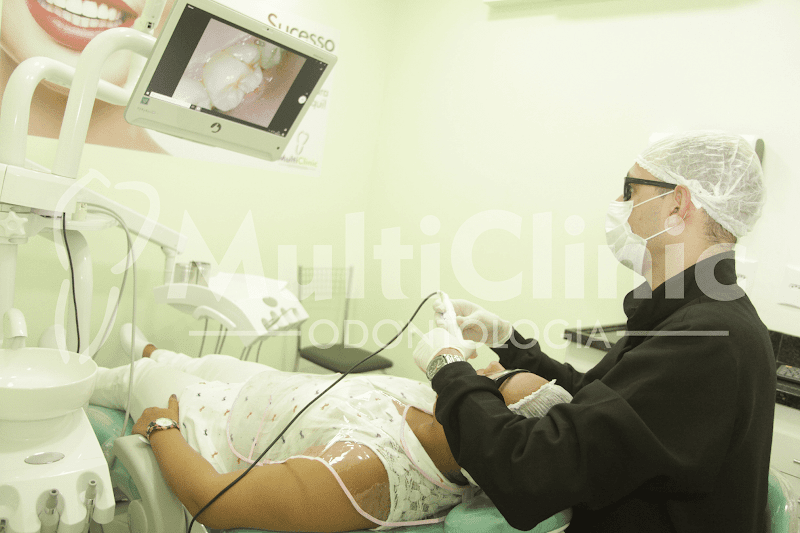 Foto 2 de Lentes em Resina e Implantes Madureira- MultiClinic Odontologia