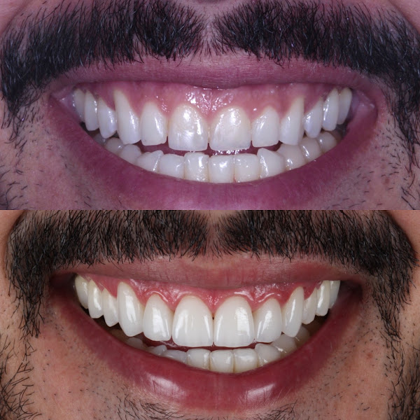 Foto 3 de Leonardo Bueno Odontologia