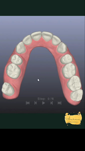 Foto 2 de Leonardo Soares- Designer de Sorriso Digital