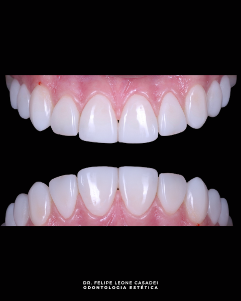 Foto 2 de LEONE ODONTOLOGIA INTEGRADA