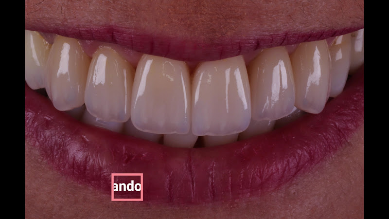 Foto 3 de Leoni Odontologia - Dr. Gustavo Loria Leoni