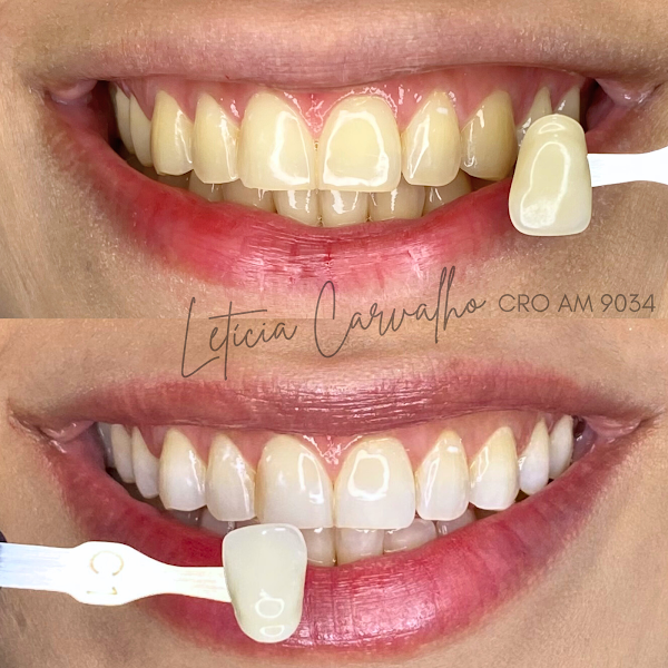 Foto 3 de Letícia Carvalho Odontologia Integrada