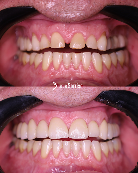 Foto 3 de Leve Sorriso | Reabilitação Oral