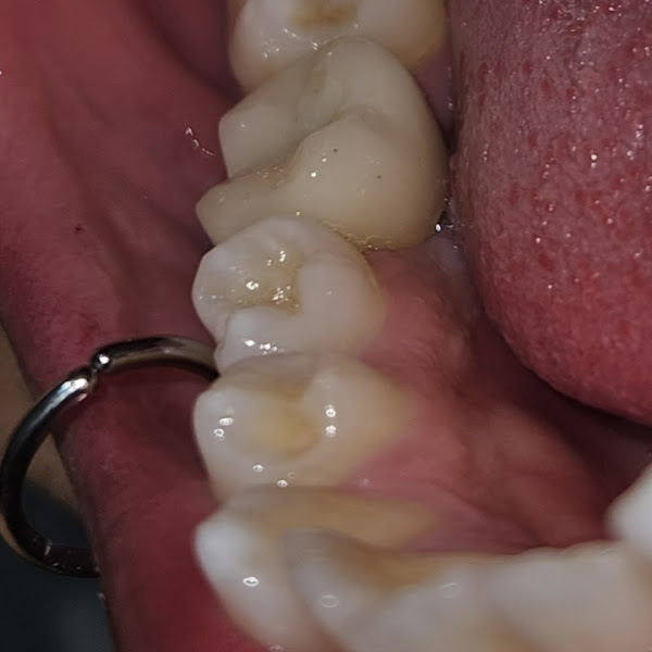 Foto 4 de Licht Odontologia - Invisalign Doctor