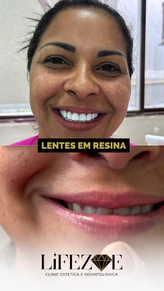 Foto 3 de LIFEZOE Clinic Estética e Odontológica