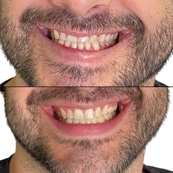 Foto 2 de Ligia Munhoz Odontologia & Estética Facial - Dentista em Mogi Guaçu