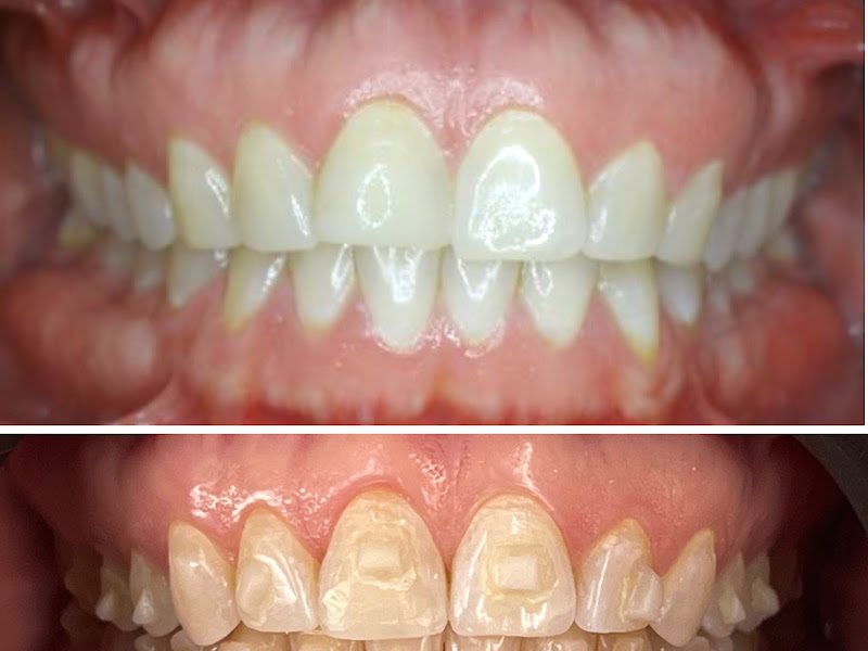 Foto 6 de Liguori & Bacellar Odontologia Conceito