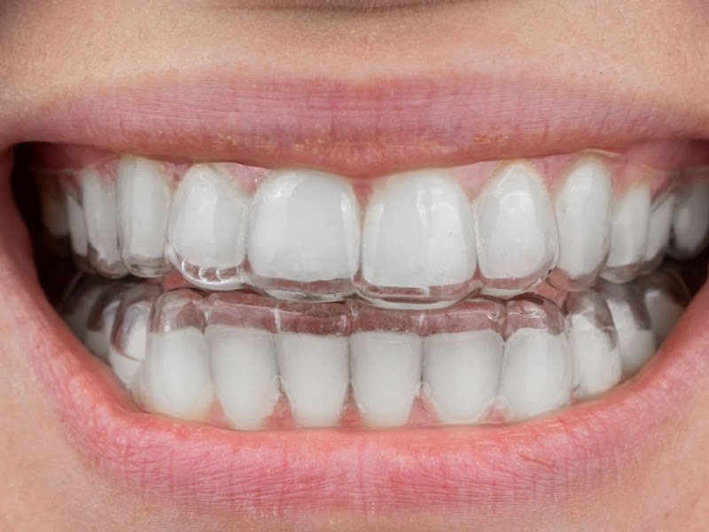 Foto 3 de LIMA Odontologia Especializada
