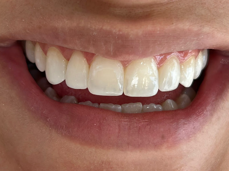 Foto 2 de Limberger Odontologia e Estética Orofacial - Convênio Prodent