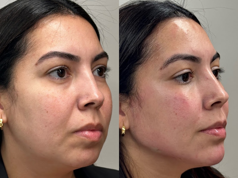 Foto 3 de Limberger Odontologia e Estética Orofacial - Convênio Prodent