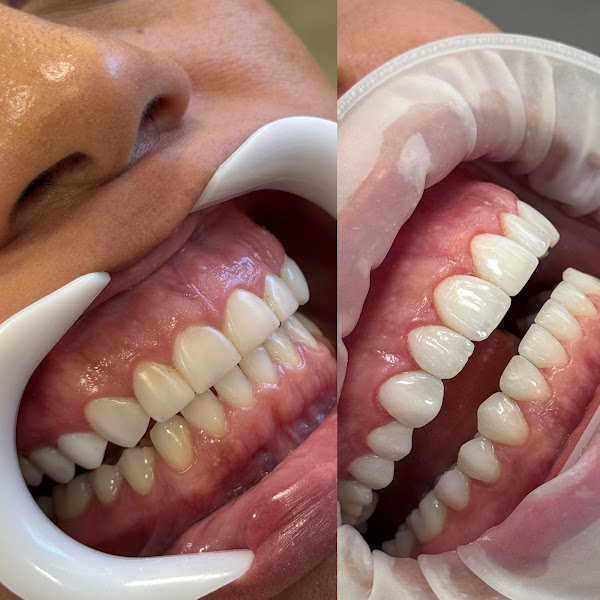 Foto 2 de Lírios Odontologia - Dra. Aline Olive