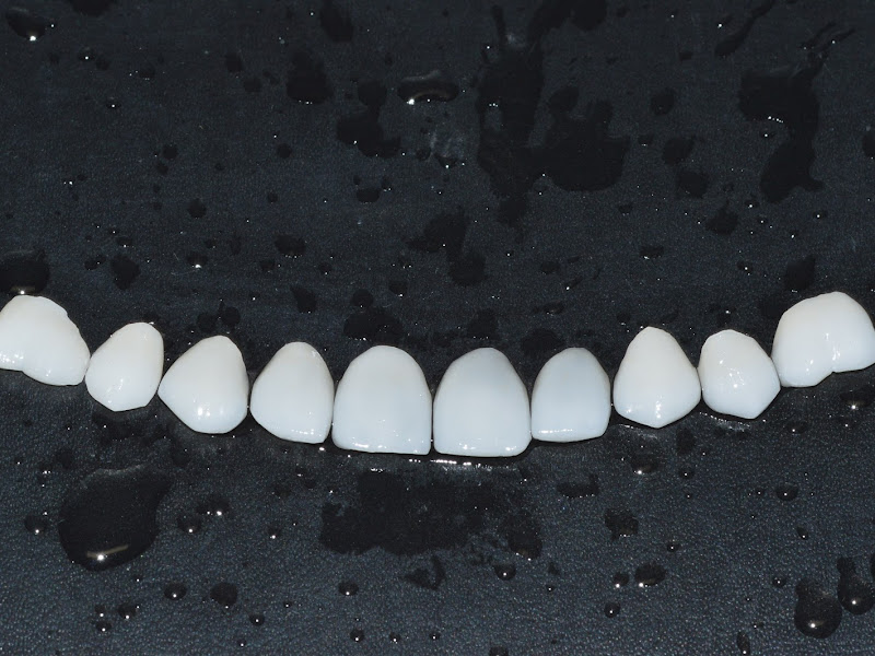 Foto 9 de Lise Ferraz - Odontologia Domiciliar