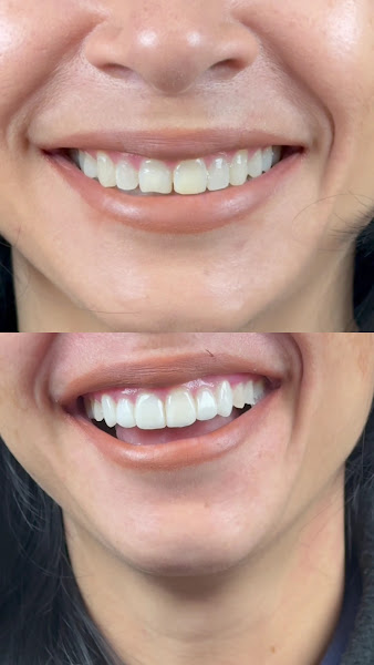 Foto 3 de LK Clinic - dentista Uberaba