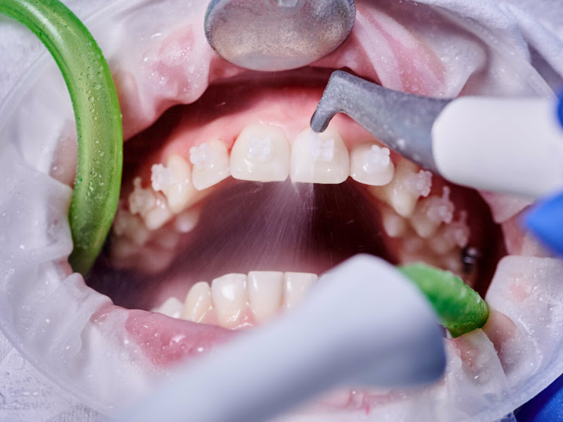 Foto 9 de LL Odontologia Especializada - Unidade 1