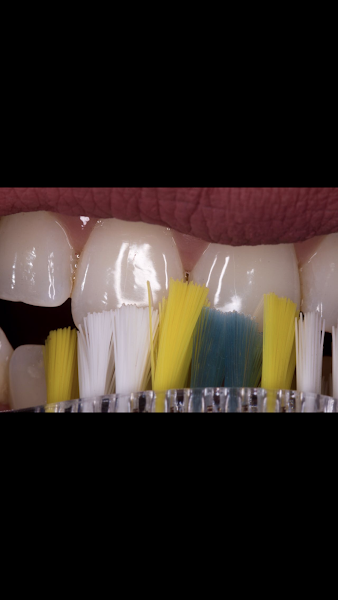 Foto 3 de Lorene Caldeira - Ortodontia - Ponta Grossa/Pr