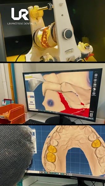 Foto 4 de LR Prótese Dental