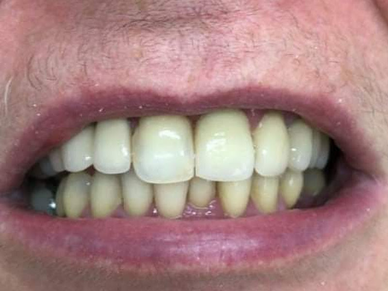 Foto 7 de LR Prótese Dental