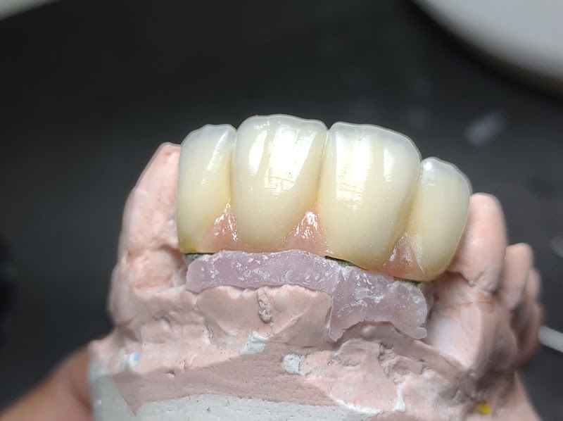 Foto 2 de LS Próteses odontológicas